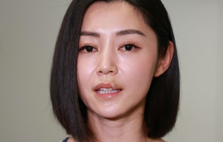 卫诗雅拍戏遭割伤缝50针，曾志伟回应：纯粹意外