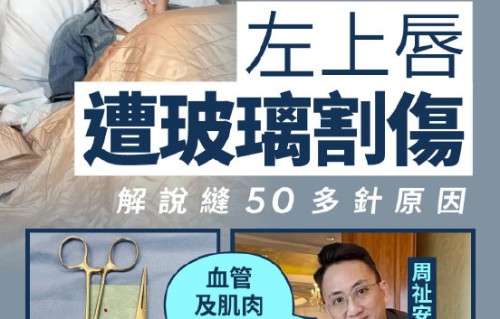 金像影后卫诗雅片场遭意外，嘴部缝50针停工休养|伤口|手术|碎片|医生|黄子华