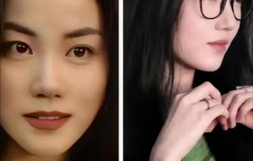 李嫣唇腭裂术后恢复情况现在如何？